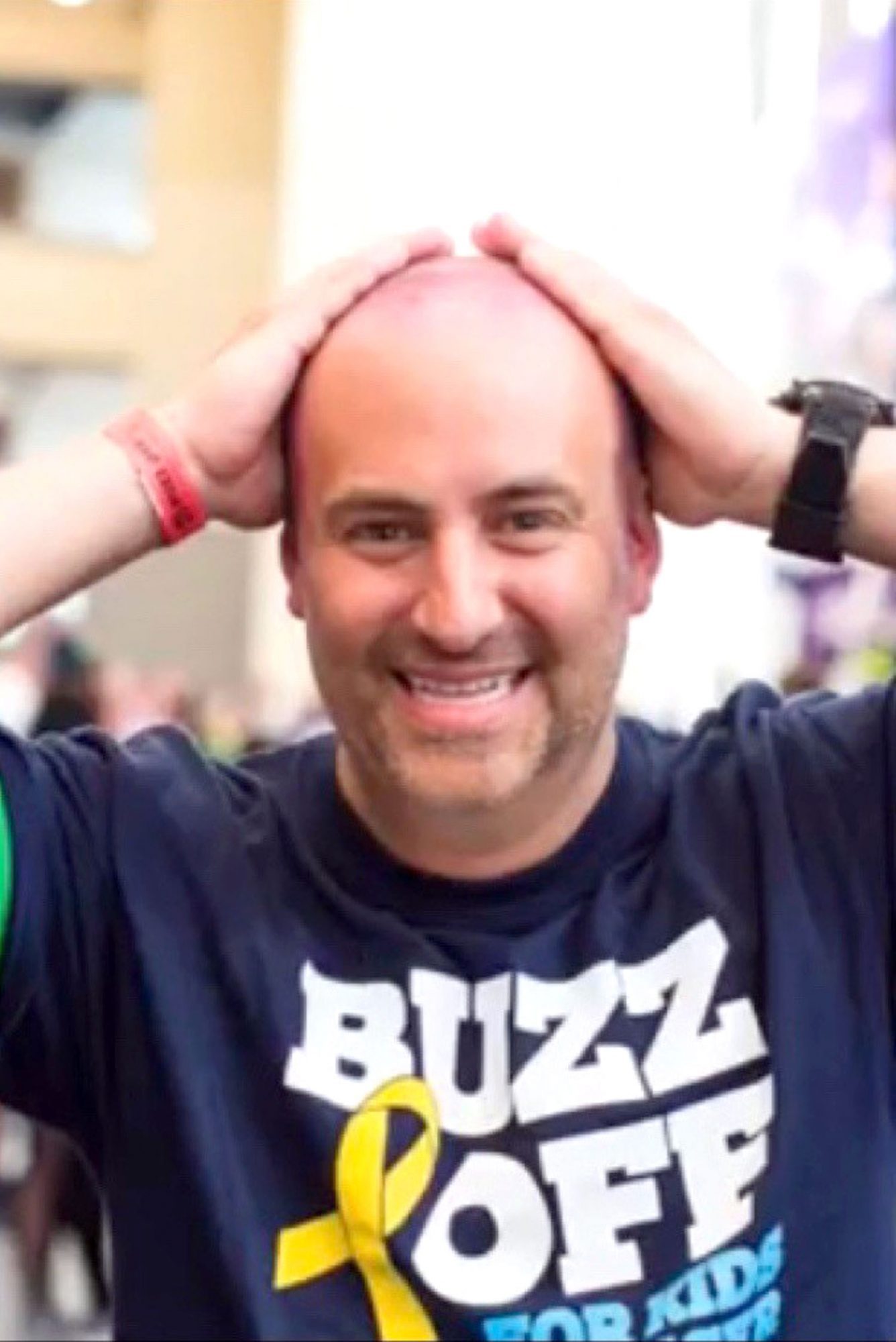 Saugus Marc Filipiak To Shave His Head To Raise Money For Pediatric